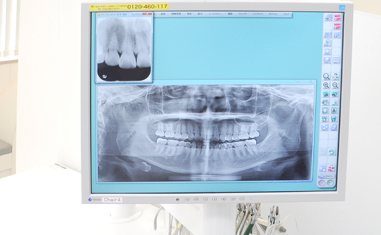 新柴又駅・木暮歯科クリニック・デジタルレントゲン